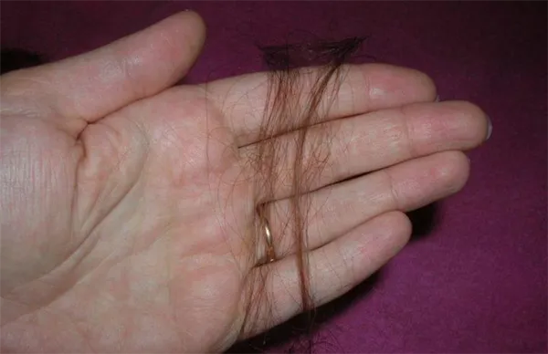Скорость роста волос: что влияет и как ускорить. За сколько отрастают волосы. 18