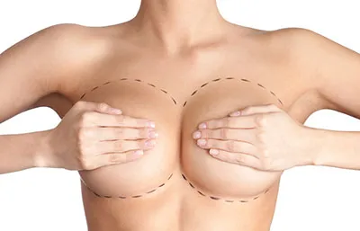 Пластическая операция груди по изменению формы ареолы