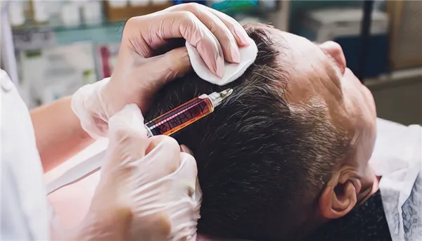 Мезотерапия для роста волос мужчинам