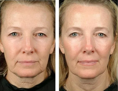 Женские секреты: как выглядеть молодой после 47-50 лет. Женщина в 48 лет выглядит. 28